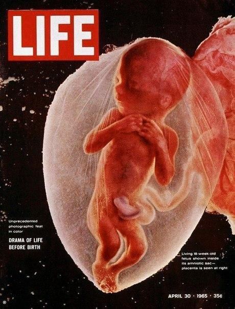 В первом номере знаменитого журнала Life, вышедшем в 1936 году, был помещён с | История без цензуры